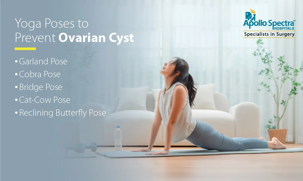 Top 10 Yoga Poses to Prevent Ovarian Cyst